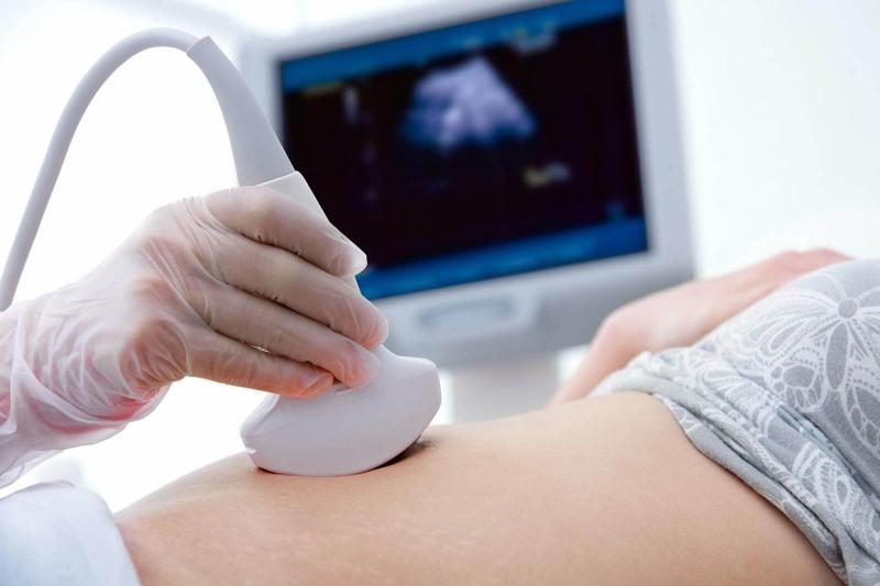 Ultrasound Preparation: Purpose, Procedure and Tips for New Patients